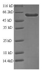 Greater than 90% as determined by SDS-PAGE.Recombinant Human Antiviral Innate Immune Response Receptor Rig-I (DDX58) Protein (His)