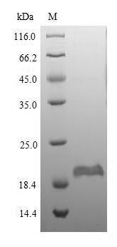 Greater than 90% as determined by SDS-PAGE.Recombinant Mouse Beta-Defensin 1 (DEFB1) Protein (His-SUMO)