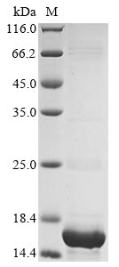 Greater than 90% as determined by SDS-PAGE.Recombinant Human Protein Dek (DEK) Protein (His&Myc)