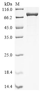 Greater than 85% as determined by SDS-PAGE.Recombinant Human Desmin (DES) Protein (EGFP)