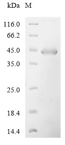 Greater than 90% as determined by SDS-PAGE.Recombinant Human Desert Hedgehog Protein (DHH) Protein (His-GST&Myc)