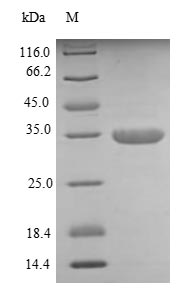 Greater than 85% as determined by SDS-PAGE.Recombinant Human Dickkopf-Related Protein 1 (DKK1) Protein (His)