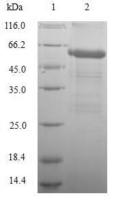 Greater than 90% as determined by SDS-PAGE.Recombinant Human Dihydrolipoyllysine-Residue Acetyltransferase Component Of Pyruvate Dehydrogenase Complex, Mitochondrial (DLAT) Protein (His)