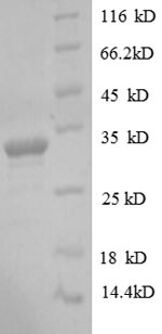 Greater than 90% as determined by SDS-PAGE.Recombinant Human Protein Delta Homolog 1 (DLK1) Protein (His)