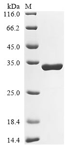 Greater than 90% as determined by SDS-PAGE.Recombinant Rat Dystrophin (DMD) Protein (His&Myc)