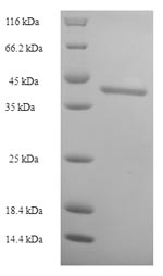Greater than 90% as determined by SDS-PAGE.Recombinant Human Dynamin-1 (DNM1) Protein (His-SUMO)