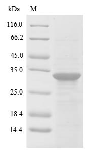 Greater than 85% as determined by SDS-PAGE.Recombinant Human Dynamin-1 (DNM1) Protein (His)