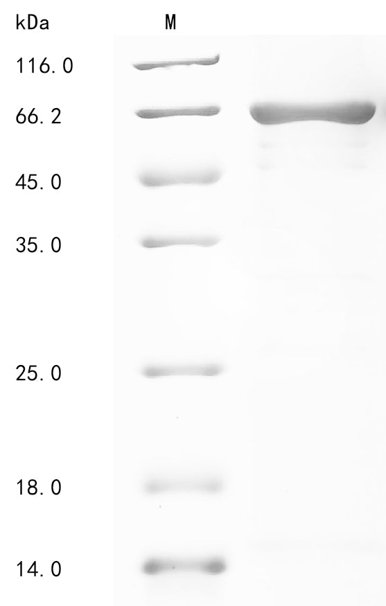 Greater than 85% as determined by SDS-PAGE.Recombinant Human Dihydropyrimidinase-Related Protein 4 (DPYSL4) Protein (His-GST&V5-Myc)