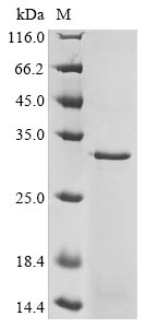 Greater than 85% as determined by SDS-PAGE.Recombinant Human D (DRD2) Protein (His&Myc)