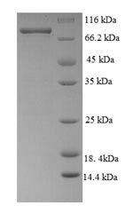 Greater than 90% as determined by SDS-PAGE.Recombinant Human Desmoglein-3 (DSG3) Protein (His-SUMO)