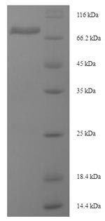 Greater than 90% as determined by SDS-PAGE.Recombinant Mouse Desmoglein-3 (DSG3) Protein (His-SUMO)