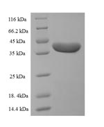 Greater than 90% as determined by SDS-PAGE.Recombinant Human Desmoplakin (DSP) Protein (His-SUMO)