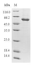 Greater than 90% as determined by SDS-PAGE.Recombinant Human Thymidylate Kinase (DTYMK) Protein (GST)