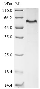 Greater than 85% as determined by SDS-PAGE.Recombinant Mouse Egf-Containing Fibulin-Like Extracellular Matrix Protein 1 (EFEMP1) Protein (His&Myc)