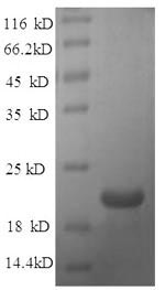 Greater than 90% as determined by SDS-PAGE.
