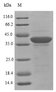 Greater than 85% as determined by SDS-PAGE.Recombinant Rat Eukaryotic Translation Initiation Factor 3 Subunit I (EIF3I) Protein (His)