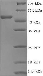Greater than 90% as determined by SDS-PAGE.Recombinant Human Neutrophil Elastase (ELANE) Protein (GST)
