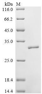 Greater than 85% as determined by SDS-PAGE.Recombinant Human Neutrophil Elastase (ELANE) Protein (His)