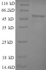 Greater than 90% as determined by SDS-PAGE.Recombinant Mouse Alpha-Enolase (ENO1) Protein (His)