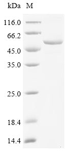 Greater than 90% as determined by SDS-PAGE.Recombinant Mouse Beta-Enolase (ENO3) Protein (His&Myc)