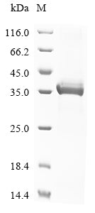 Greater than 90% as determined by SDS-PAGE.Recombinant Mouse Ectonucleotide Pyrophosphatase/Phosphodiesterase Family Member 1 (ENPP1) Protein (His)