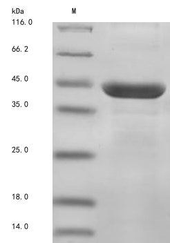Greater than 85% as determined by SDS-PAGE.Recombinant Rat Ectonucleoside Triphosphate Diphosphohydrolase 1 (ENTPD1) Protein (His)