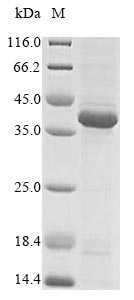 Greater than 85% as determined by SDS-PAGE.Recombinant Human Ephrin Type-A Receptor 2 (EPHA2) Protein (His&Myc)