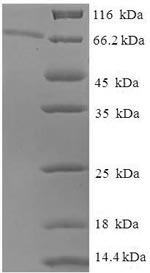 Greater than 90% as determined by SDS-PAGE.Recombinant Human Epoxide Hydrolase 1 (EPHX1) Protein (His-SUMO)