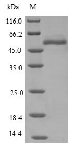 Greater than 85% as determined by SDS-PAGE.Recombinant Human Epoxide Hydrolase 1 (EPHX1) Protein (His)