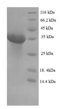 Greater than 90% as determined by SDS-PAGE.