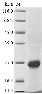 Greater than 85% as determined by SDS-PAGE.