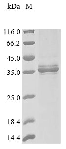 Greater than 85% as determined by SDS-PAGE.Recombinant Dog Erythropoietin Receptor (EPOR) Protein (His-GB1&His)