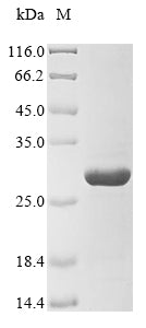Greater than 85% as determined by SDS-PAGE.Recombinant Rat Erythropoietin Receptor (EPOR) Protein (His)