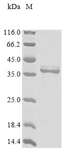 Greater than 85% as determined by SDS-PAGE.Recombinant Rat Erythropoietin Receptor (EPOR) Protein (His-GB1&His)