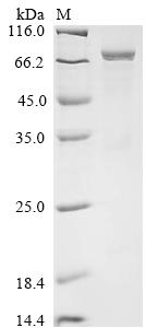 Greater than 85% as determined by SDS-PAGE.Recombinant Human Eosinophil Peroxidase (EPX) Protein (His)