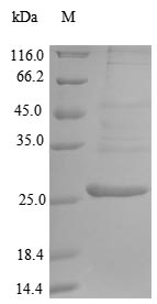 Greater than 90% as determined by SDS-PAGE.Recombinant Mouse Endoplasmic Reticulum Aminopeptidase 1 (ERAP1) Protein (His&Myc)