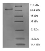 Greater than 90% as determined by SDS-PAGE.Recombinant Human Receptor Tyrosine-Protein Kinase Erbb-2 (ERBB2) Protein (His)