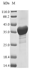 Greater than 85% as determined by SDS-PAGE.Recombinant Human Receptor Tyrosine-Protein Kinase Erbb-2 (ERBB2) Protein (His&Myc)