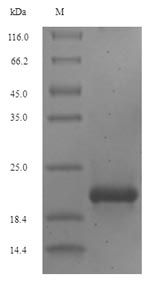 Greater than 90% as determined by SDS-PAGE.