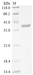 Greater than 90% as determined by SDS-PAGE.Recombinant Human Endoplasmic Reticulum Metallopeptidase 1 (ERMP1) Protein (His)