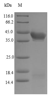 Greater than 85% as determined by SDS-PAGE.Recombinant Human Estrogen Receptor Beta (ESR2) Protein (His)