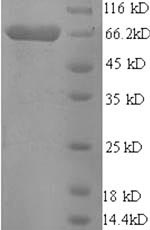 Greater than 90% as determined by SDS-PAGE.Recombinant Pig Electron Transfer Flavoprotein-Ubiquinone Oxidoreductase, Mitochondrial (ETFDH) Protein (His-SUMO)