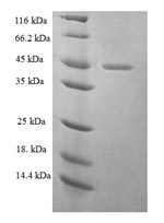 Greater than 90% as determined by SDS-PAGE.Recombinant Human Ezrin (EZR) Protein (His-SUMO)