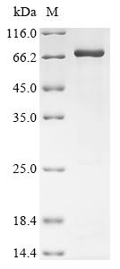 Greater than 85% as determined by SDS-PAGE.Recombinant Rat Coagulation Factor X (F10) Protein (His&Myc)