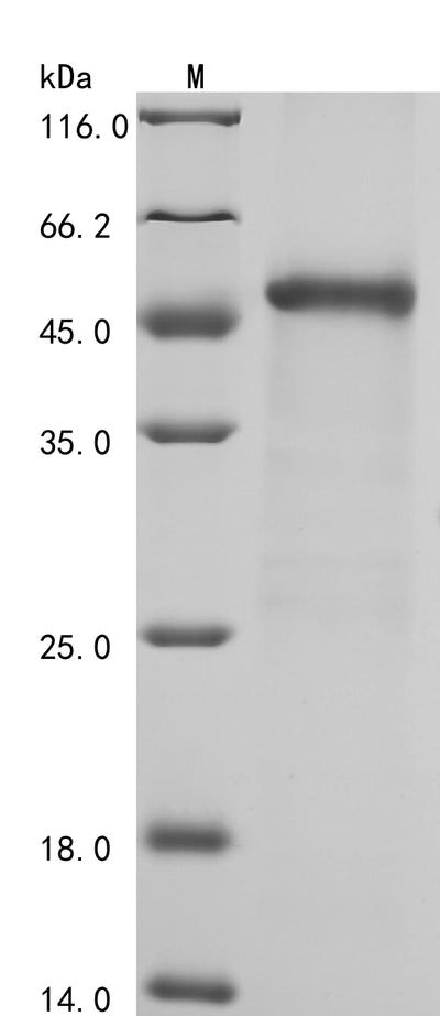 Greater than 90% as determined by SDS-PAGE.Recombinant Human Coagulation Factor Xiii B Chain (F13B) Protein (His-GST&Myc)