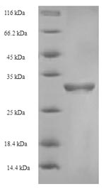 Greater than 90% as determined by SDS-PAGE.Recombinant Human Coagulation Factor V (F5) Protein (His-SUMO)