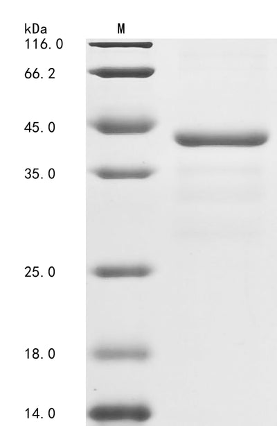 Greater than 85% as determined by SDS-PAGE.Recombinant Human Coagulation Factor Ix (F9) Protein (His-GST)