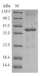 Greater than 90% as determined by SDS-PAGE.Recombinant Human Fatty Acid-Binding Protein (FABP5) Protein (GST)