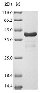 Greater than 90% as determined by SDS-PAGE.Recombinant Human Fatty Acid-Binding Protein 5 (FABP5) Protein (His)