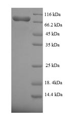 Greater than 90% as determined by SDS-PAGE.Recombinant Human Fanconi Anemia Group C Protein (FANCC) Protein (His-SUMO)